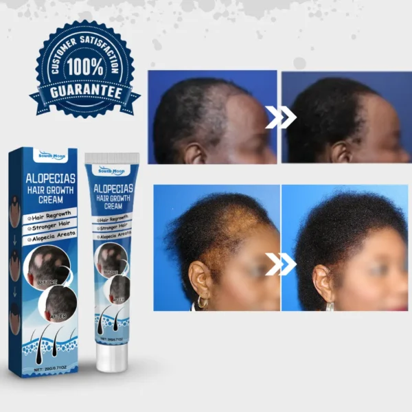 Alopecia Hair Growth Cream 100% proven working - Image 13
