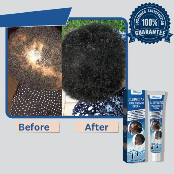 Alopecia Hair Growth Cream 100% proven working - Image 11