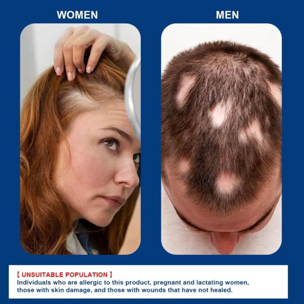 Alopecia Hair Growth Cream 100% proven working - Image 9