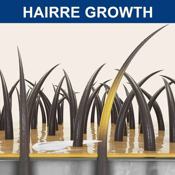 Alopecia Hair Growth Cream 100% proven working - Image 7