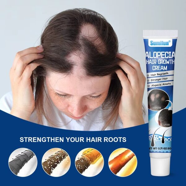 Alopecia Hair Growth Cream 100% proven working - Image 12
