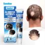 Alopecia Hair Growth Cream 100% proven working