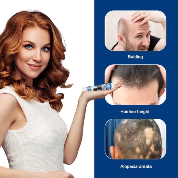 Alopecia Hair Growth Cream 100% proven working - Image 3