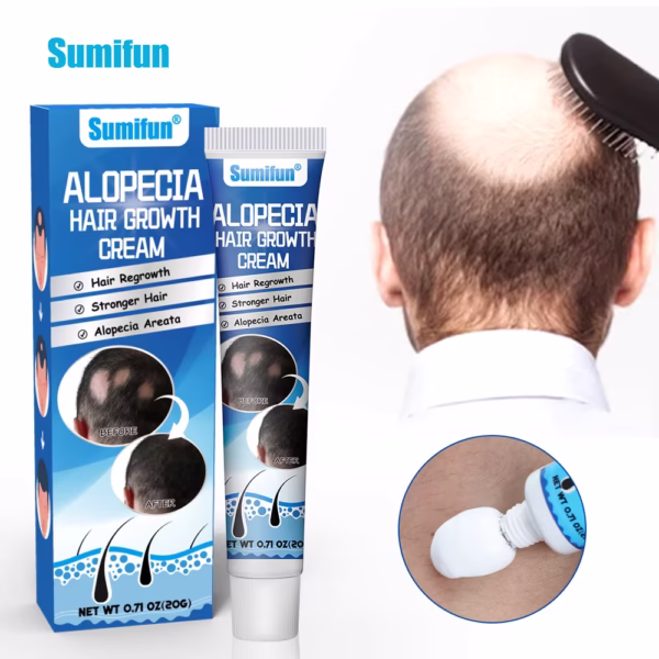 Alopecia Hair Growth Cream 100% proven working - Image 2